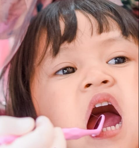 Fluortreatment / Imunisasi Gigi Anak